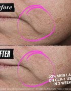 Kiehl's CollaShot Plump Serum колагенов серум за попълване и възстановяване на кожата на лицето за жени 30 мл.