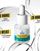 Kiehl's Dermatologist Solutions Truly Targeted Blemish-Clearing Solution серум за кожа с акне за жени 15 мл.