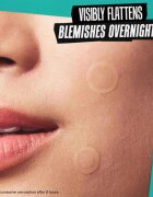 Kiehl's Truly Targeted Overnight Blemish Patch лепенки за проблемна кожа за жени 22 бр.