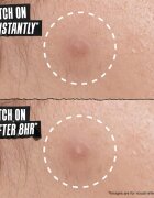 Kiehl's Truly Targeted Overnight Blemish Patch лепенки за проблемна кожа за жени 22 бр.