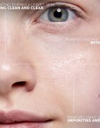 La Roche-Posay Effaclar Ultra почистваща мицеларна вода за проблемна кожа акне 200 мл.
