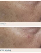 LANCER GRAVITY DARK SPOT CORRECTING SERUM серум Против тъмни петна 30 мл.