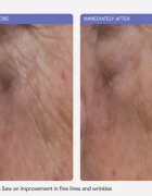 LANCER Ultra Rich Barrier Cream хидратиращ крем с церамиди за укрепване на кожната бариера 50 мл.