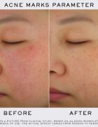 Lancôme Clarifique Refining Brightening Pro-Solution озаряващ серум 50 мл.