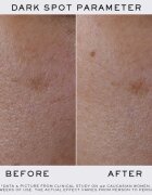 Lancôme Clarifique Refining Brightening Pro-Solution озаряващ серум 50 мл.