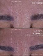 Lancôme Rénergie Collagen+ Lift-Xtend Cream крем за лице с колаген 50 мл.