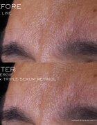 Lancôme Rénergie CRX Triple Serum Retinol серум за лице 20 мл.