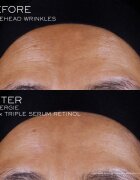Lancôme Rénergie CRX Triple Serum Retinol серум за лице 20 мл.