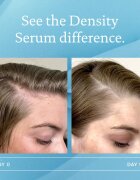 Living Proof Scalp Care серум за обновяване на гъстотата на косата 50 мл.