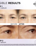 L’Oréal Paris Revitalift Filler комплект за грижа за лице за зоната на лицето и очите