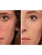L’Oréal Paris True Match The One течен коректор цвят 1.R/C Rose Ivory 6.8 мл.