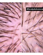 L’Oréal Professionnel Serie Expert Scalp Advanced козметика за коса за коса и скалп 200 мл.