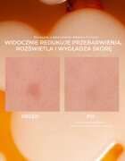 Lumene Nordic-C [VALO] Dark Spot Serum озаряващ серум с витамин С против пигментни петна 30 мл.