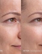 Mádara MÁDARA Kojic Alternative Pigment Serum серум против пигментни петна 30 мл.