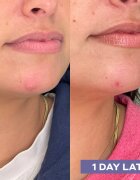 Mario Badescu Repairing Facial Spray With Hypochlorous Acid обновяващ спрей за лице за успокояване на кожата 118 мл.