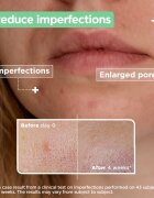MIXA Anti-Imperfection серум за проблемна кожа акне 30 мл.