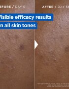 MIXA Niacinamide Bright интензивен хидратиращ крем Против тъмни петна 400 мл.