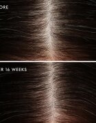 Moroccanoil Scalp Conditioner успокояващ балсам за мазна кожа на скалпа против пърхот 250 мл.