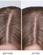 Moroccanoil Scalp Dry Scalp Treatment дълбоко подхранваща грижа за суха кожа 45 мл.