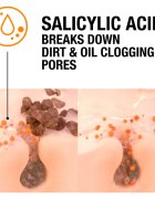 Neutrogena Blackhead Eliminating пилинг против черни точки 150 мл.