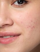 Neutrogena Clear & Defend+ химически пилинг 125 мл.
