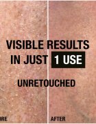 Neutrogena Intense Repair Cica подаръчен комплект за жени