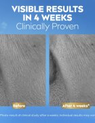 Nivea Q10 Anti-Wrinkle Collagen Expert серум против бръчки с колаген 30 мл.