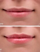 Notino Hydrating Sun Shield Lip Balm защитен балсам за устни с хидратиращ ефект SPF 30 10 мл.