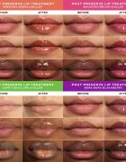 OLEHENRIKSEN Pout Preserve Chillers Passport To Chill комплект за устни