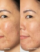 OLEHENRIKSEN Transform Glow 2OH Dark Spot Toner тоник за лице Против тъмни петна 190 мл.