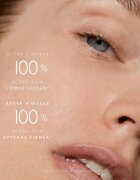 Omorovicza Queen Serum подмладяващ серум за лице 30 мл.