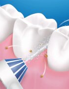 Oral-B Aquacare 4 душ за устна хигиена 1 бр.