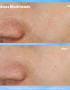Origins Clear Improvement® Blackhead Clearing Mask-To-Scrub маска за почистване на порите от черни точки 75 мл.