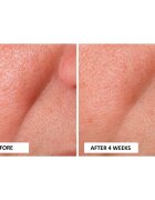 Perricone MD Cold Plasma Plus+ Advanced Serum подхранващ серум за лице 30 мл.