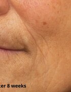 Perricone MD Cold Plasma Plus+ Hydrating Complex интензивен хидратиращ гел 59 мл.