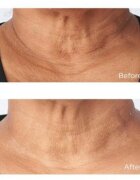 Perricone MD Cold Plasma Plus+ Sub-D/Neck стягащ крем за шия и деколте 59 мл.