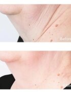 Perricone MD Cold Plasma Plus+ Sub-D/Neck стягащ крем за шия и деколте 59 мл.
