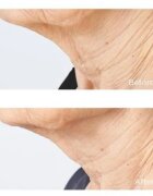 Perricone MD Cold Plasma Plus+ Sub-D/Neck стягащ крем за шия и деколте 59 мл.