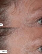 Perricone MD Cold Plasma Plus+ The Essence есенция за лице 140 мл.