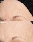 Perricone MD Cold Plasma Plus+ The Intensive Hydrating Complex интензивен хидратиращ гел 30 мл.