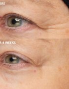 Perricone MD Cold Plasma Plus+ The Intensive Hydrating Complex интензивен хидратиращ гел 30 мл.