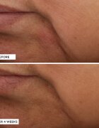 Perricone MD Essential Fx Acyl-Glutathione Moisturizer хидратиращ и подмладяващ крем против бръчки 30 мл.