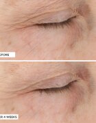 Perricone MD Essential Fx Acyl-Glutathione Moisturizer хидратиращ и подмладяващ крем против бръчки 30 мл.