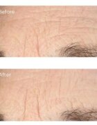 Perricone MD Essential Fx Acyl-Glutathione Serum хидратиращ серум против дълбоки бръчки 30 мл.