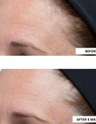 Perricone MD High Potency Classics Intensive Moisturizer интензивен хидратиращ гел с хиалуронова киселина 30 мл.