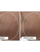 Perricone MD High Potency Classics Intensive Moisturizer интензивен хидратиращ гел с хиалуронова киселина 30 мл.