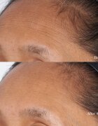 Perricone MD High Potency Intensive Hydrating Mask интензивно хидратираща маска за лице с хиалуронова киселина 59 мл.