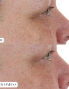 Perricone MD High Potency Night Moisturizer нощен крем за възстановяване стегнатостта на кожата 59 мл.