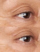 Perricone MD Hypoallergenic Clean Correction Eye Cream хидратираща и озаряваща грижа за клепачи и кръгове под очите 15 мл.
