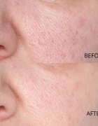 Perricone MD Hypoallergenic Clean Correction Smoothing Restorative Serum изглаждащ серум за хидратация и озаряване на кожата 59 мл.